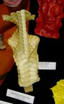 Spinal Reconstruction and Red Man Mask