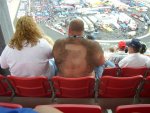 hairy back