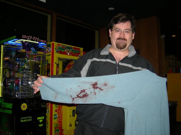 ice skating: the outcome of Matt's hockey mishap